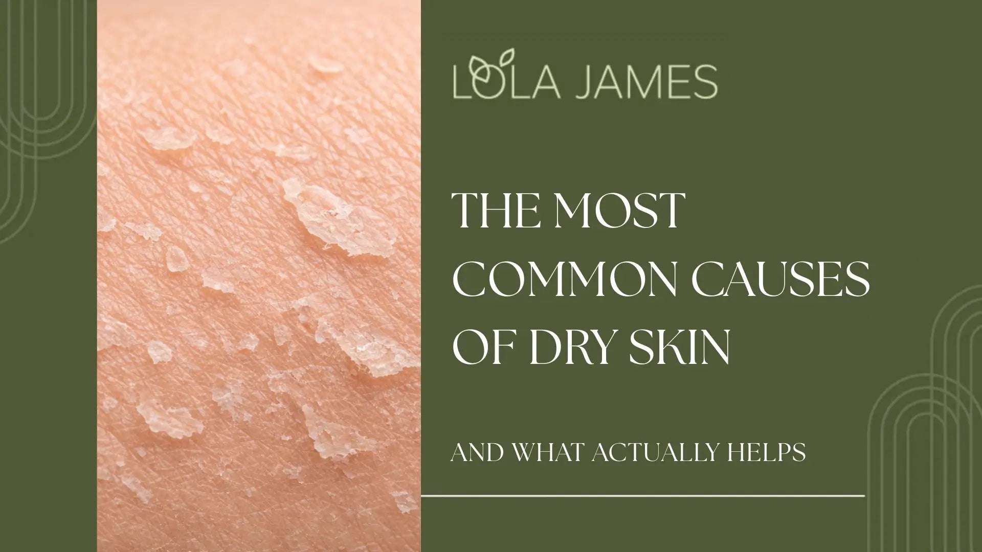 Why Is My Skin So Dry?